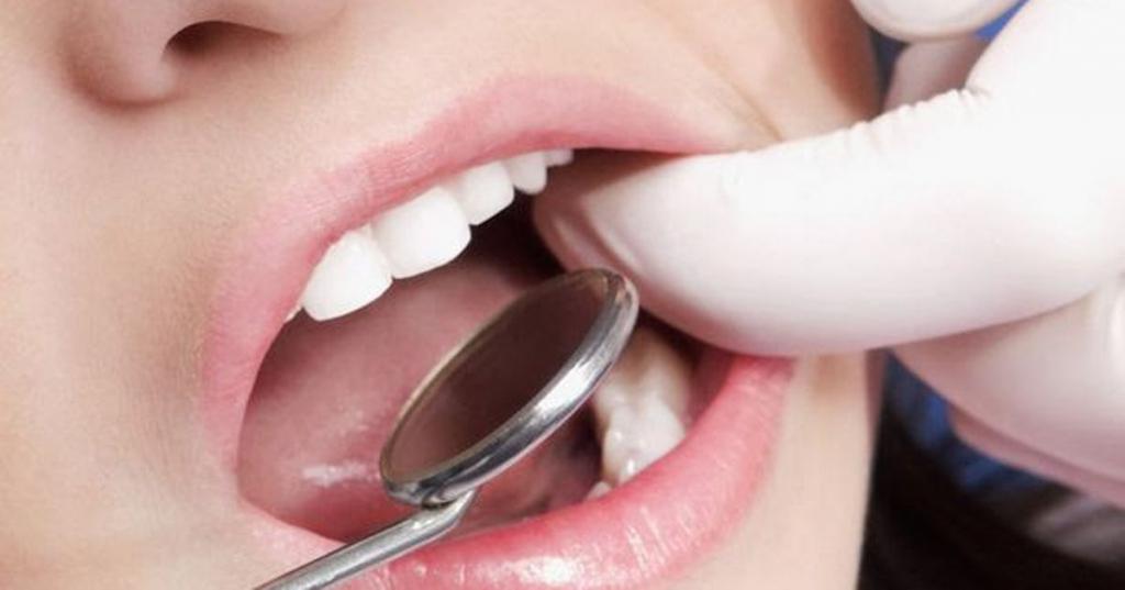 Что делать, если шатается зуб | Советы по решению дентальных проблем 17