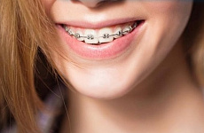 Детская стоматология 👧 в Московском круглосуточно: лечение, удаление зубов. Онлайн запись к детскому стоматологу 48