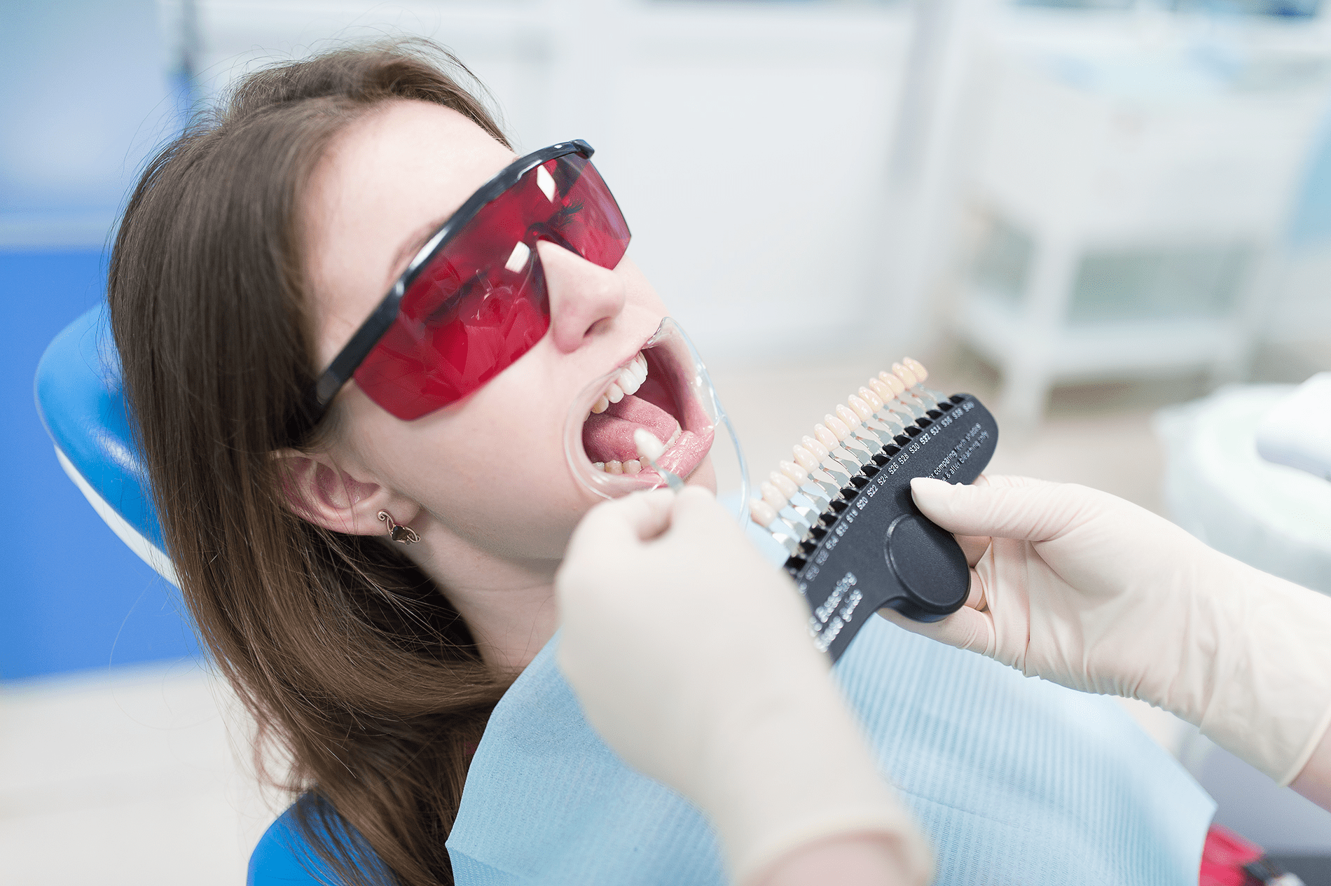 Для чего и как проводится отбеливание зубов