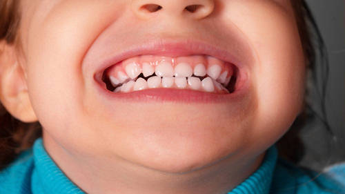 Ребенок скрипит зубами: причины